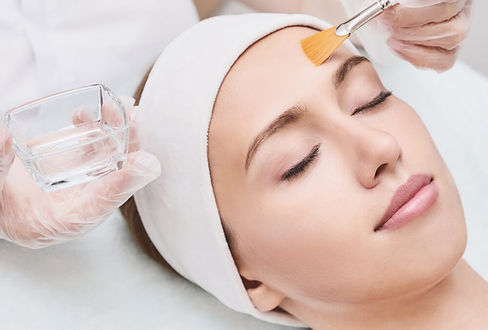 chemical peel1.jpeg