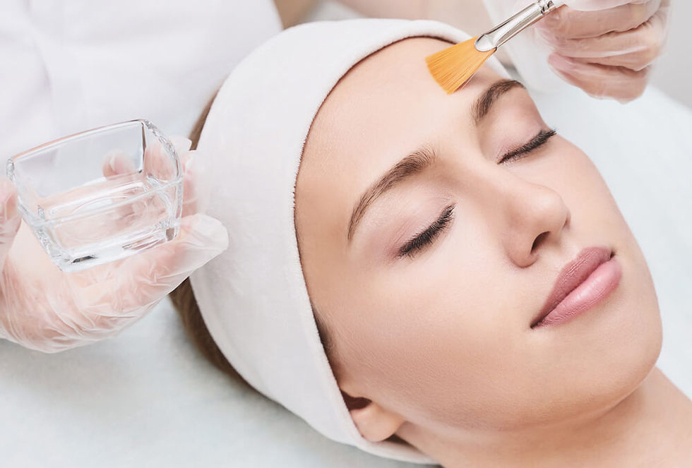 Chemical Peels