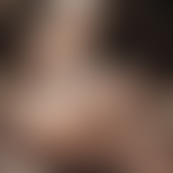 Mastering the Femoral Triangle: Mnemonic "NAVO-OVAN"