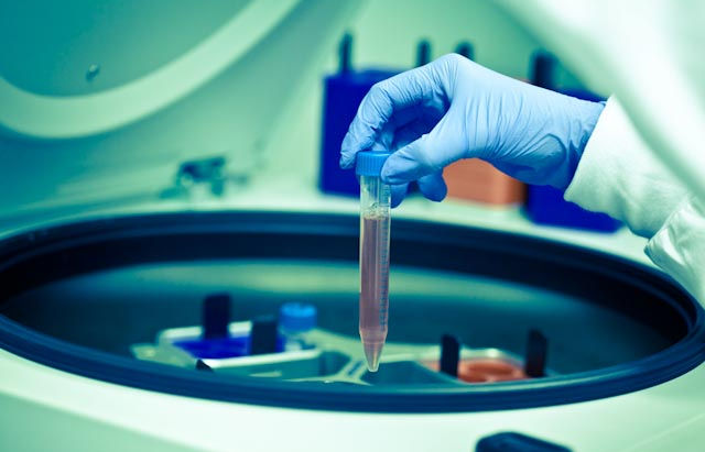 קדימהסטם מודיעה על תוצאות ביניים מבטיחות של קבוצת הטיפול הראשונה בניסוי הקליני במחלת הניוון שרירים