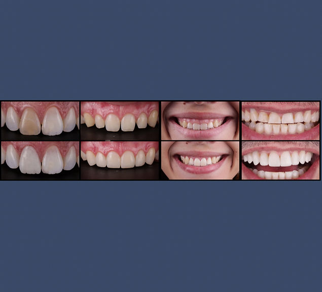 antes e depois_edited.jpg