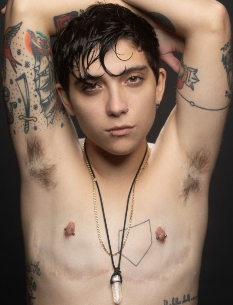 A light-skinned man with his arms raised above his head, revealing hairy armpits and a flat chest with top surgery scars. He has a lip piercing and tattoos. 