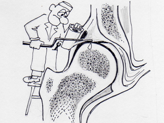 DO YOU NEED A HIP JOINT REPLACEMENT?