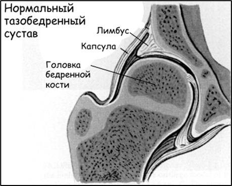 Normal hip joint. Labrum. Joint capsule. Head of femur.