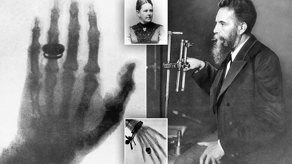 Röntgen’s discovery was groundbreaking. For the first time, physicians had a non-invasive method to observe the internal condition of their patients.