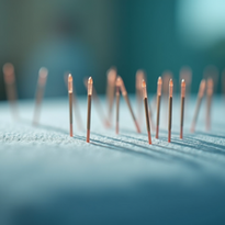 How Acupuncture Helps Alleviate Everyday Pain