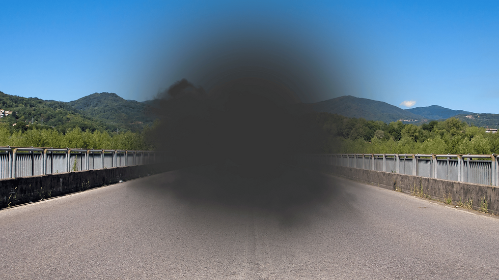 Central vision loss seen in age-related macular degeneration