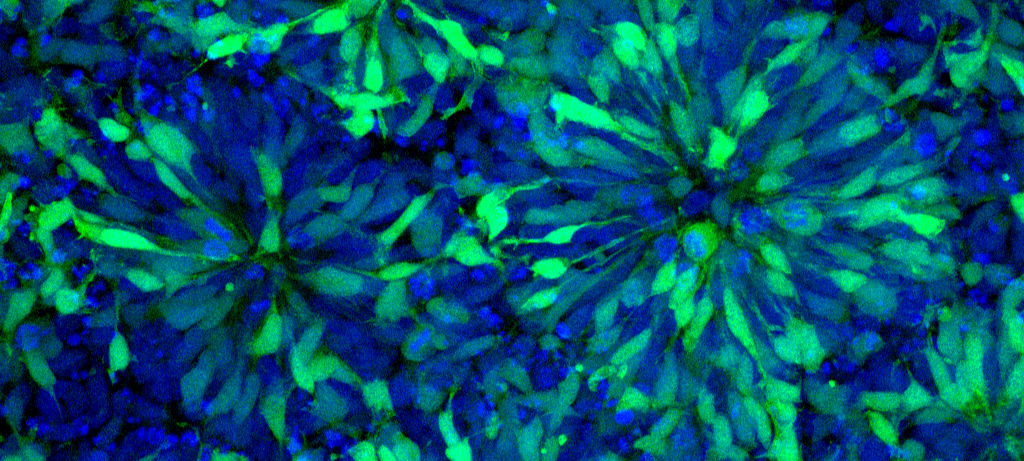 Uninfected HES5_GFP 4G2_555 PAX6_633 DAPI z-sec X40 maximumintensityprojection_edited.jpg