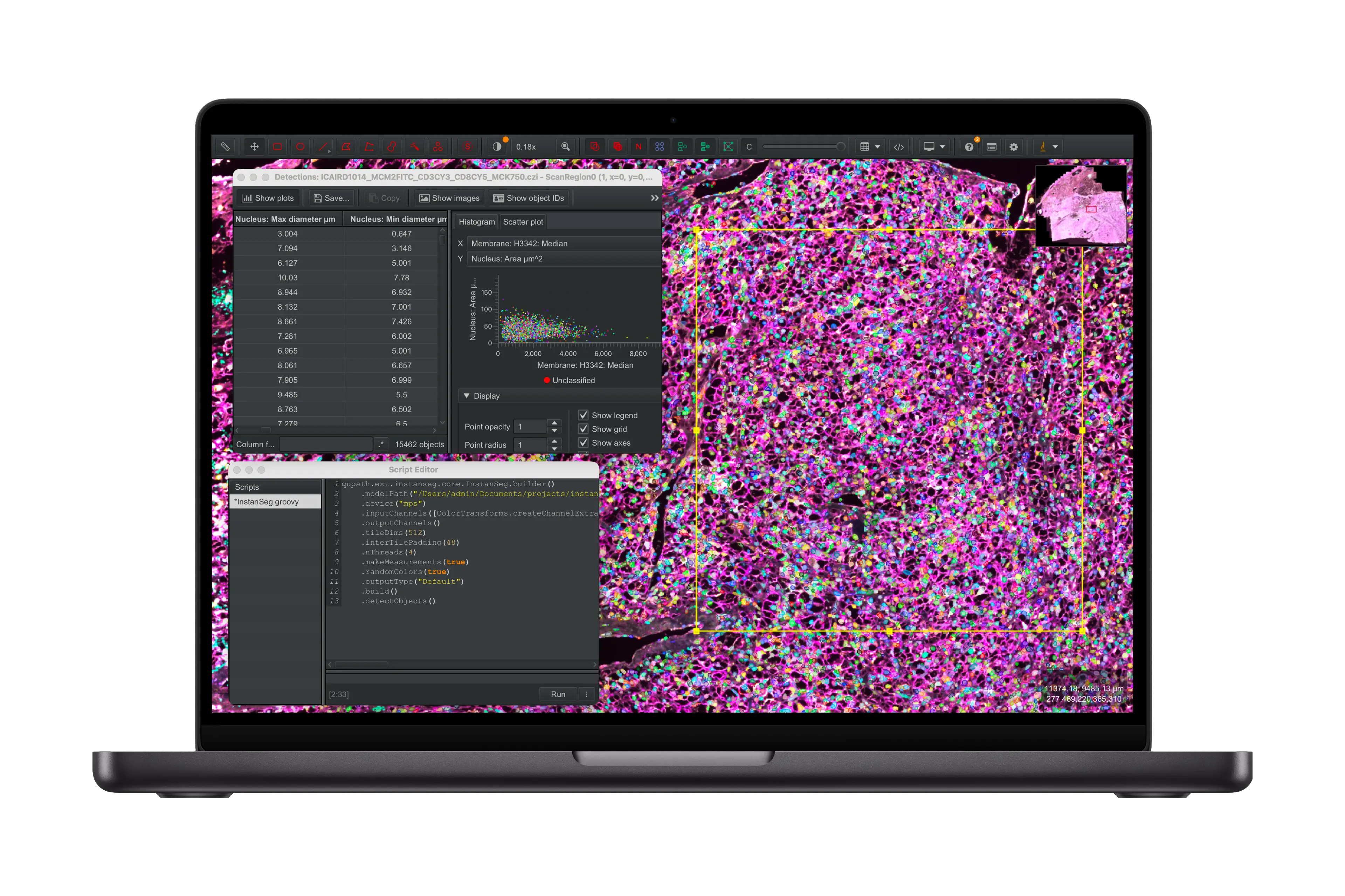 Un MacBook Pro M5 affiche un écran QuPath.