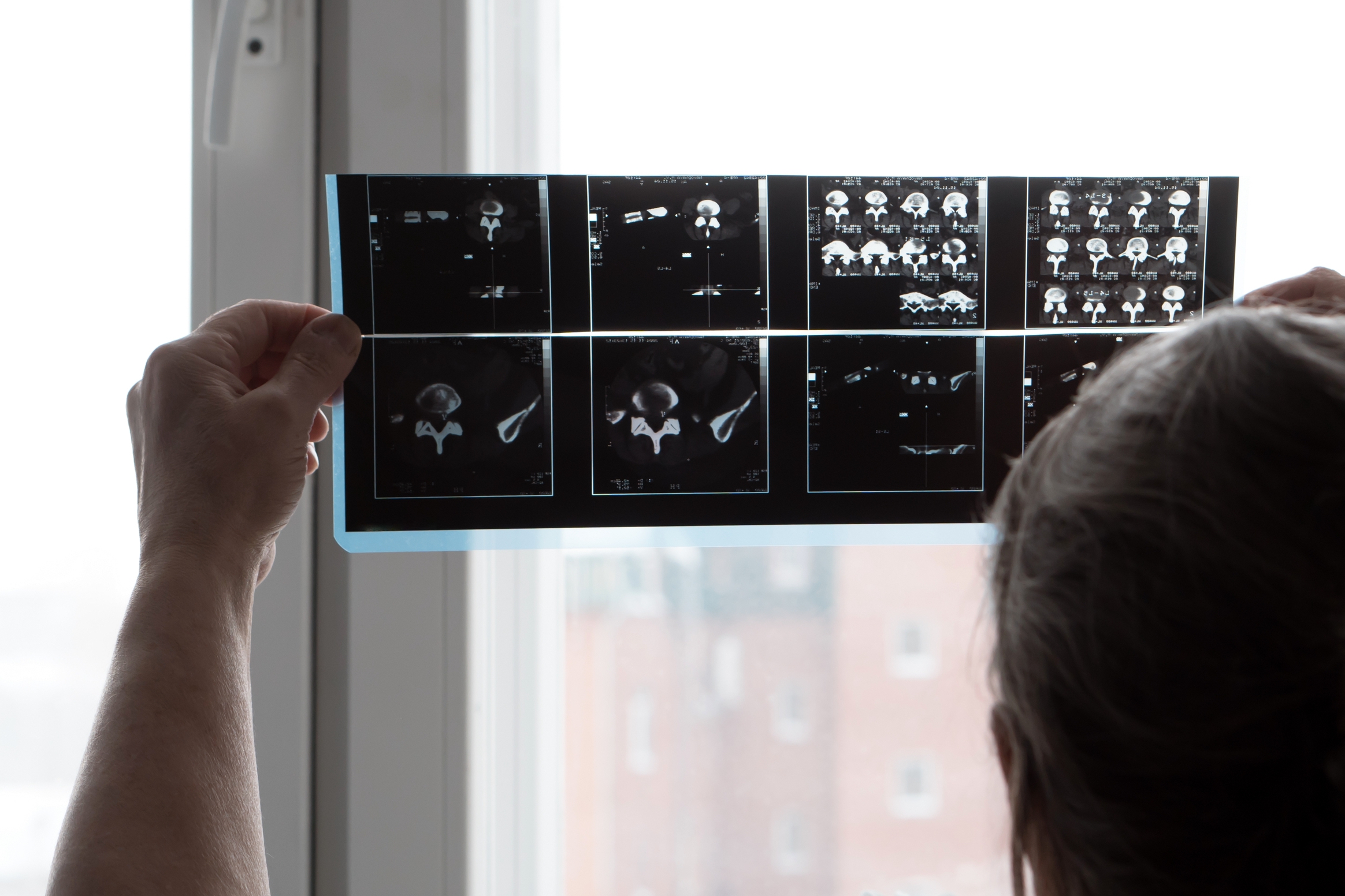 What is an ARRT® Credential?