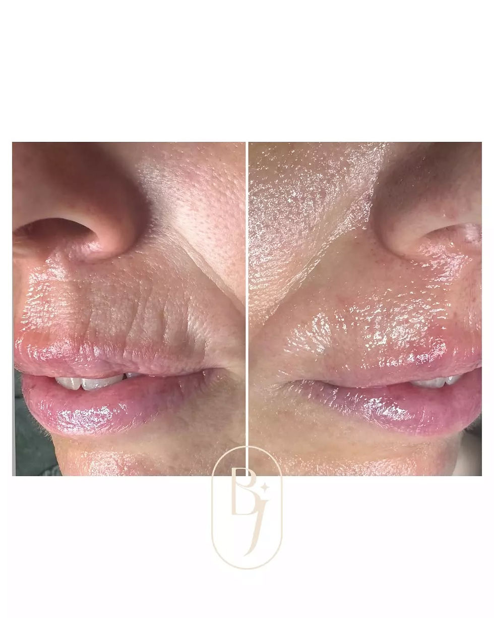 skincare 4