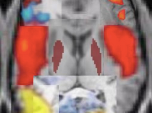 Critical Thinking and Pop Sci: We Use More Than 10% of Our Brains!