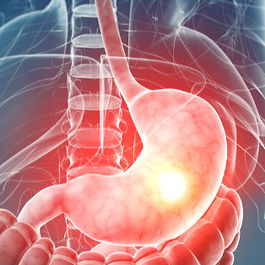 reflux surgery