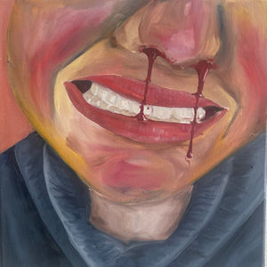 The Nosebleed, Part 3
