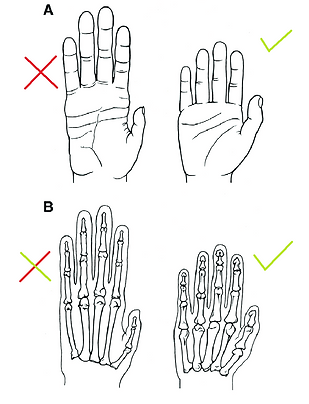 Fig1-Comparison-of-the-external-A-and-sk
