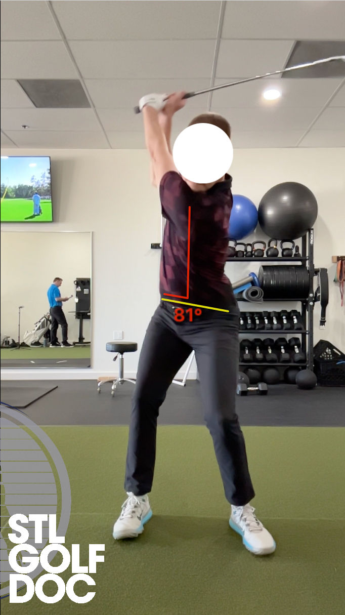 Male golfer working with the Saint Louis Golf Doc. Face on view showcasing excessive spine rotation.