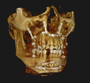 DVT / CBCT Interdisziplinärer Strahlenschutz - Sachverständigenkurs 2025