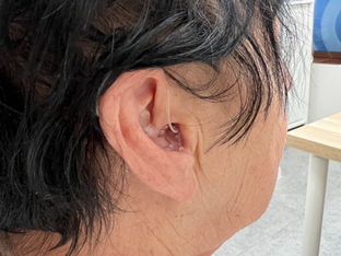 Aparat słuchowy RIC na uchu pacjenta Fonika Fonica Warszawa