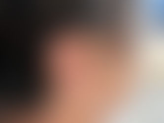 Aparat słuchowy RIC na uchu pacjenta Fonika Fonica Warszawa