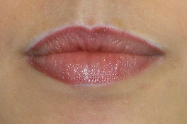 Lippenkonturierung, Lippenrand
