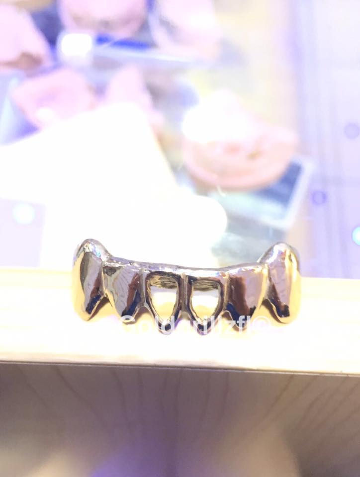 White Gold