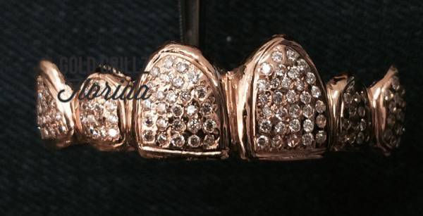 Custom gold Grillz