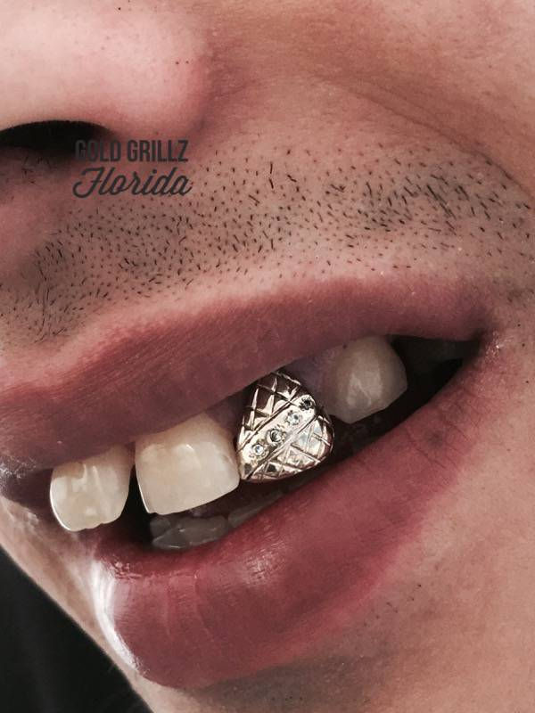 White gold cap