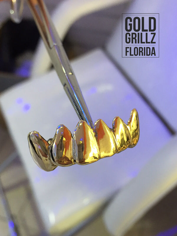 Yellow Gold