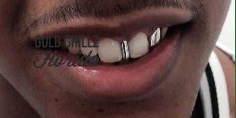 Polished white gold
