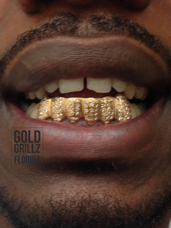 Gold