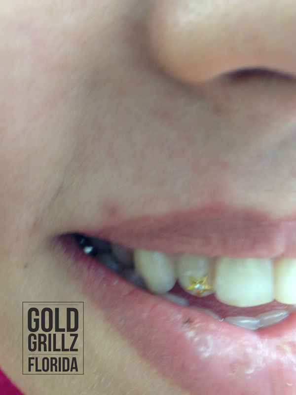 Gold star tooth