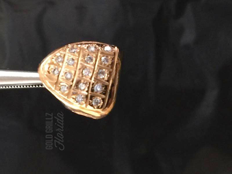 Gold cap