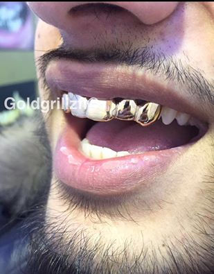 White Gold