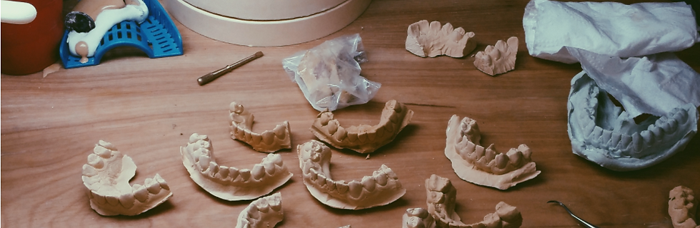 Gold teeth molding