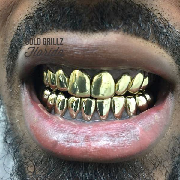 Custom gold Grillz