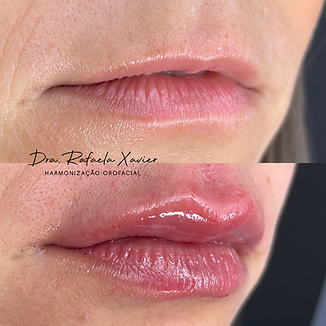 labios.png