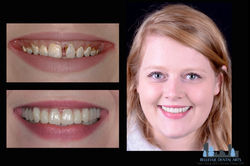 Kari before and after copy