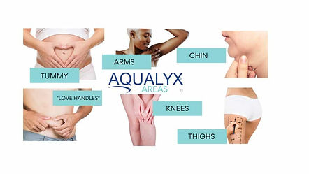 AQUALYX-AREAS-1024x576.jpeg