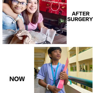 Pulmonary Valve Stenosis (PVS): A Grateful Heart - My Son’s Story of Survival and Hope