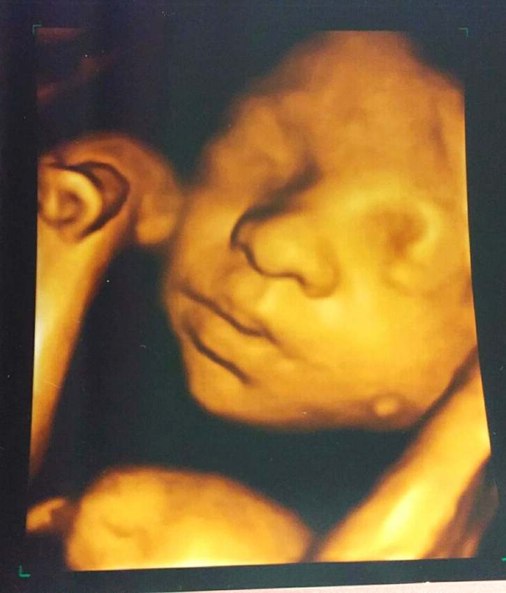 Our Babies