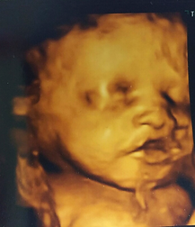 4d ultrasound paducah