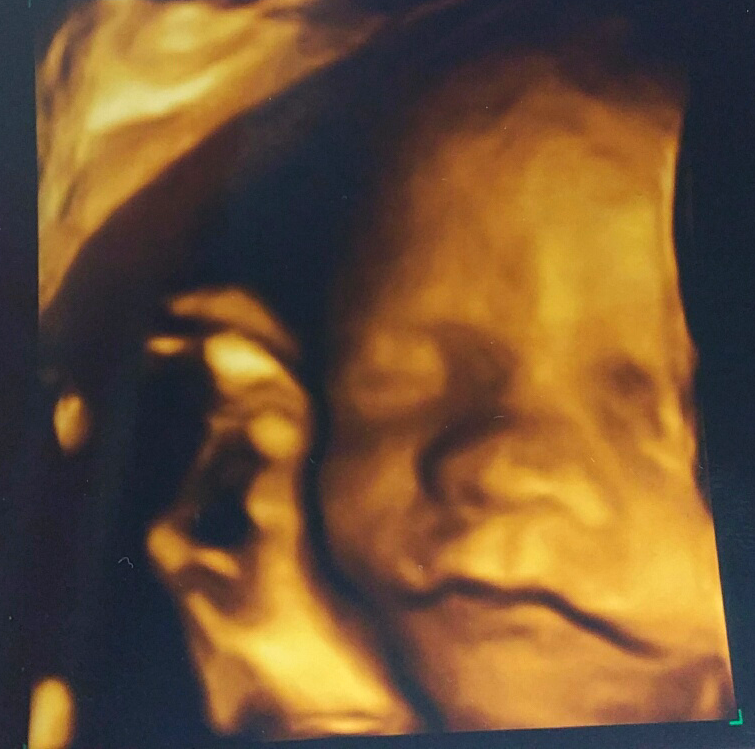 Our Babies