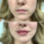 Lips 10.jpg