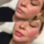 Lips 2.jpg