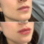 Lips 3.jpg