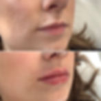 Lips 12.jpg