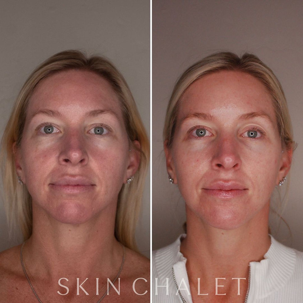 Facial Balancing (1).jpg