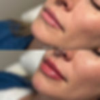 Lips 15.jpg
