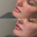 Lips 1.jpg
