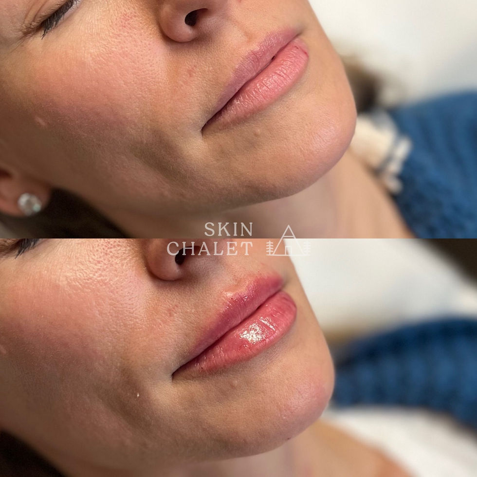 Lips 20